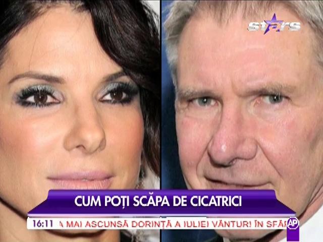 Cum poți scăpa de cicatrici