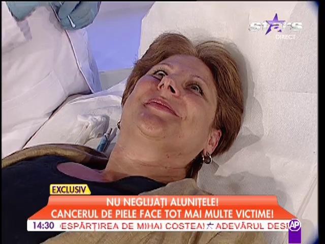 Nu neglijaţi aluniţele şi papiloamele! Cancerul de piele face tot mai multe victime!