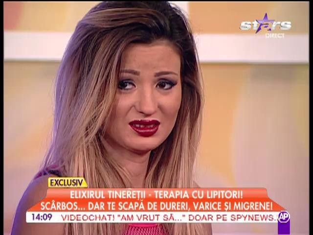 Elixirul tinereţii - Terapia cu lipitori!  Sc&acirc;rbos...  dar te scapă de dureri, varice şi migrene