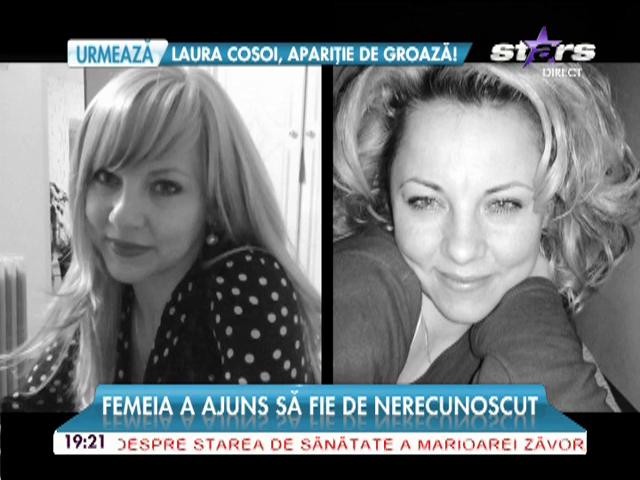O t&acirc;nără a fost desfigurată de o injecţie!