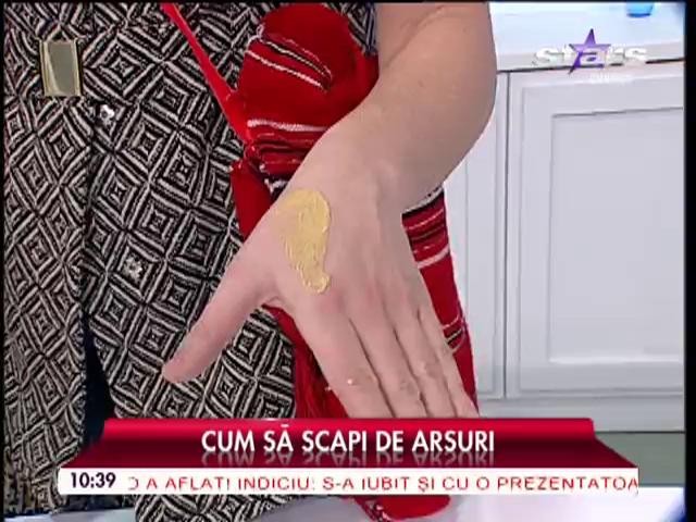 Cum să scapi de arsuri cu ajutorul muştarului