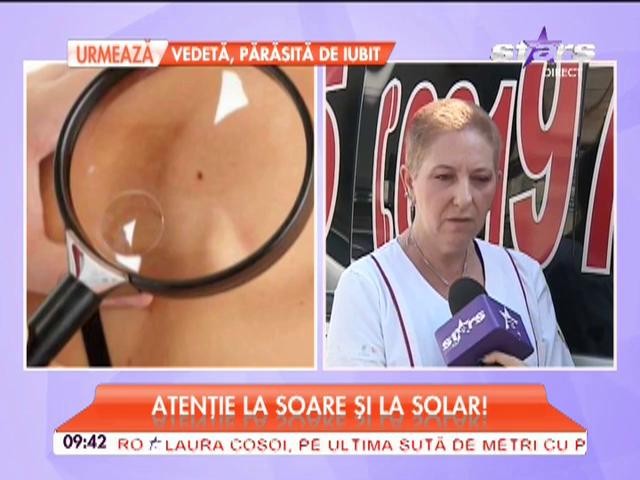 ATENŢIE! Ce se &icirc;nt&acirc;mplă dacă &icirc;ţi expui aluniţele la soare sau la solar