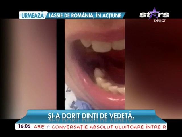 Şocant! A dorit dinţi de vedetă, dar a ajuns la spital cu o gaură &icirc;n g&acirc;t