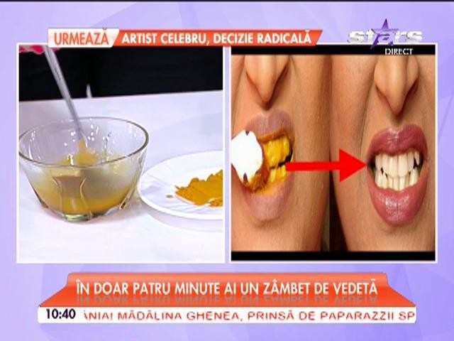 Adio bani aruncaţi pe tratamente de albire. &Icirc;n 4 minute ai un z&acirc;mbet de vedetă! Ai nevoie de două ingrediente