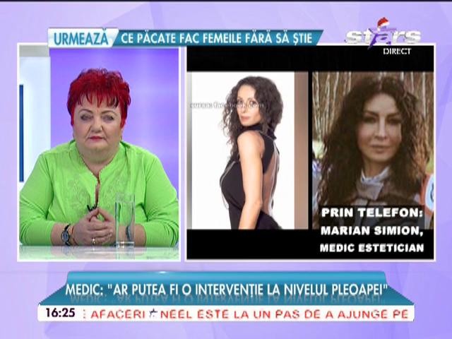 Mihaela Rădulescu, plină de operaţii? Medicul specialist i-a analizat chipul şi a dat verdictul!