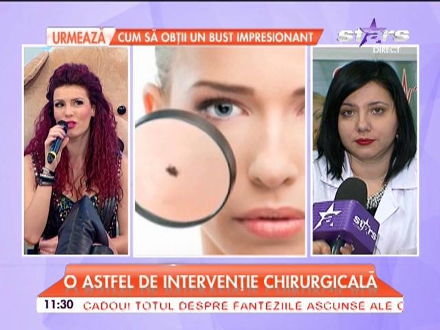 Vrei să &icirc;ţi scoţi aluniţele de pe faţă? Medicii spun care sunt toate riscurile la care te expui