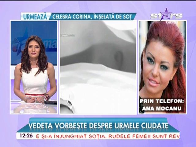 Ana Mocanu vorbeşte despre urmele ciudate de sub s&acirc;n! Ce ascunde fotografia care a şocat toată presa