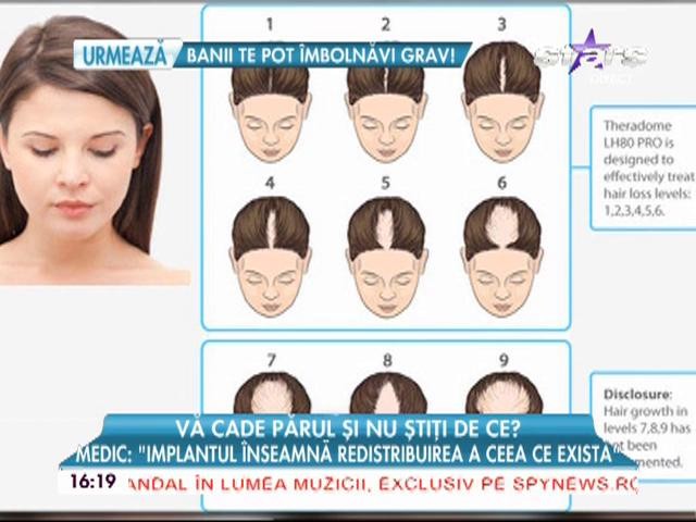 Ce spun medicii specialiști despre tratamentele naturiste &icirc;mpotriva căderii părului