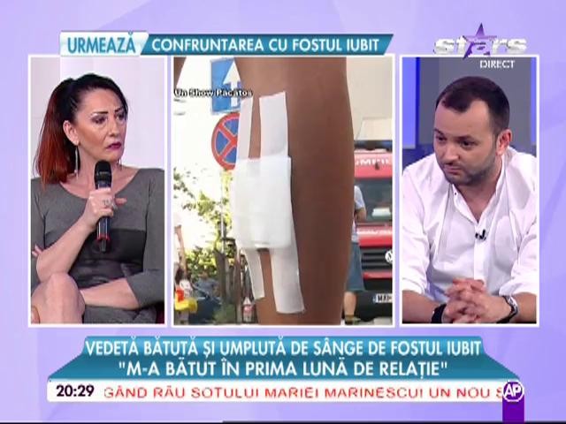 Coşmarul continuă. După ce a fost snopită &icirc;n bătaie, vecinii lui Rose fac mărturisiri despre episodul violent