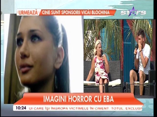 Imagini horror cu EBA! Buzele ei mai au puțin și explodează