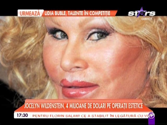 Și vedetele de la Hollywood exagerează! Vedetele care s-au distrus din cauza operațiilor