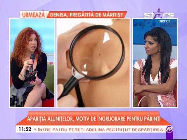 Ce sunt aluniţele şi cum trebuie tratate!