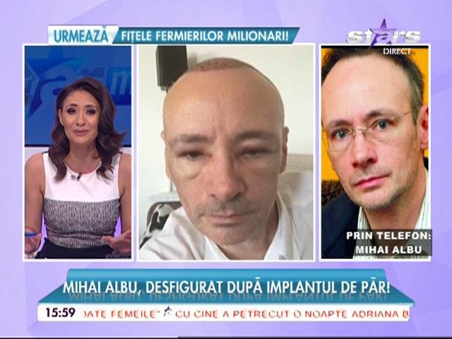 Mihai Albu, desfigurat după intervenție!