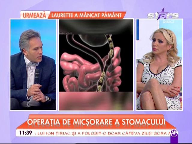 Care sunt riscurile operaţiei de micşorare a stomacului