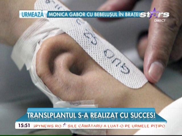 Un medic specializat &icirc;n chirurgie plastică a crescut o ureche pe m&acirc;na pacientului