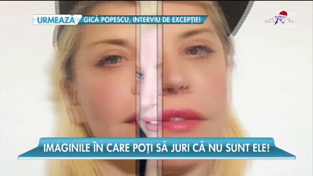Divele Rom&acirc;niei, de nerecunoscut, din cauza operaţiilor estetice!