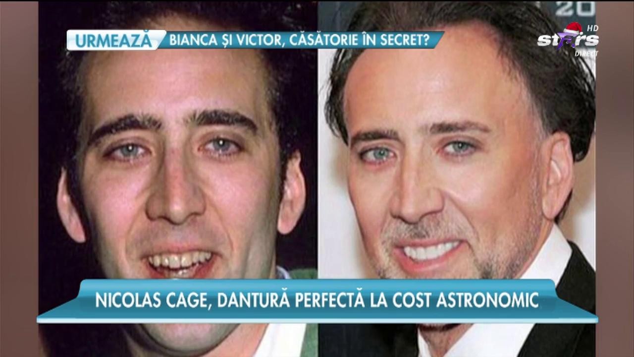 Vedetele care au cerut ajutorul unui dentist pentru a avea z&acirc;mbetul perfect