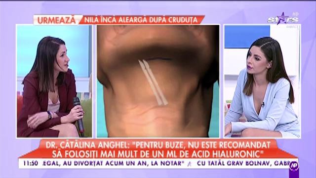 C&acirc;t de periculoase sunt operațiile estetice