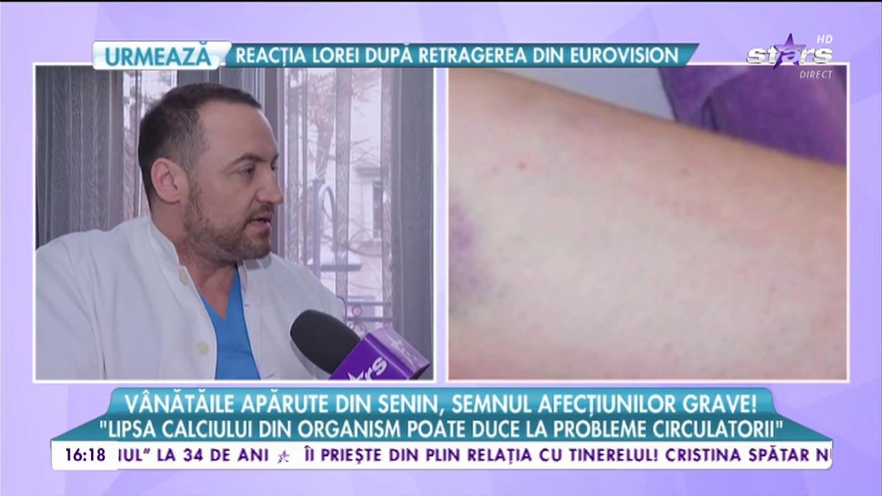 V&acirc;nătăile apărute din senin, semnul unor afecțiuni grave
