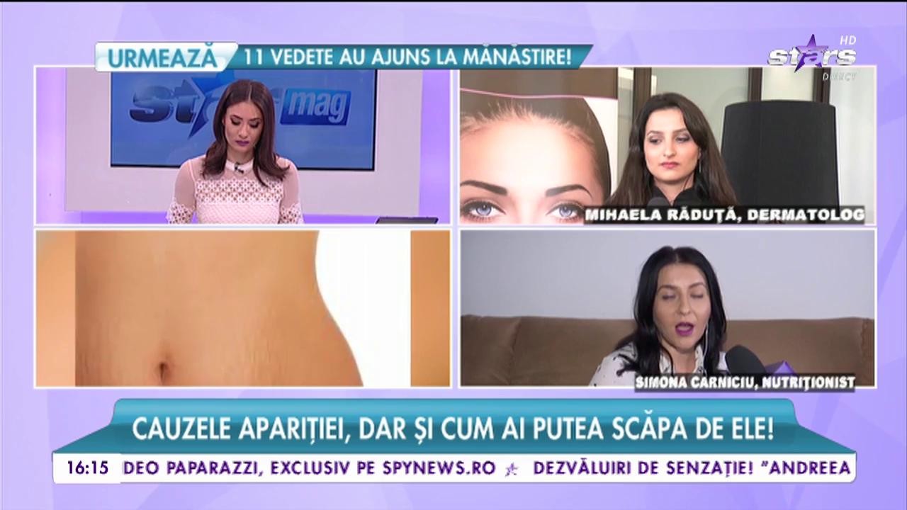 Cauzele apariției vergeturilor, dar și cum pot fi tratate
