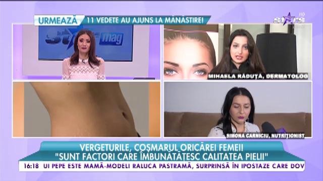 Vergeturile, coşmarul oricarei femei. Ce sunt, de ce apar şi cum poţi să le tratezi