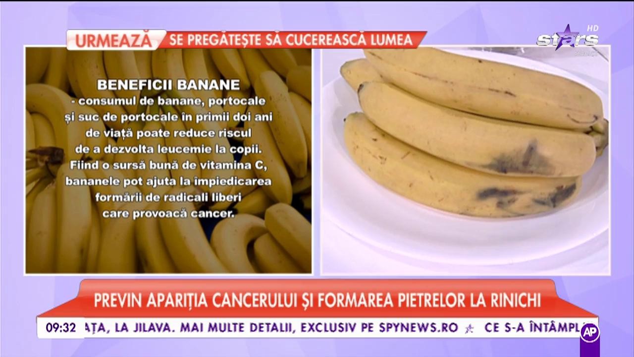 O banană pe zi te ţine departe de doctor