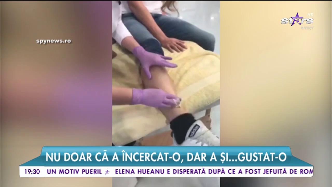 Cea mai nouă metodă de epilare! Răzvan Botezatu s-a epilat &Icirc;N DIRECT!