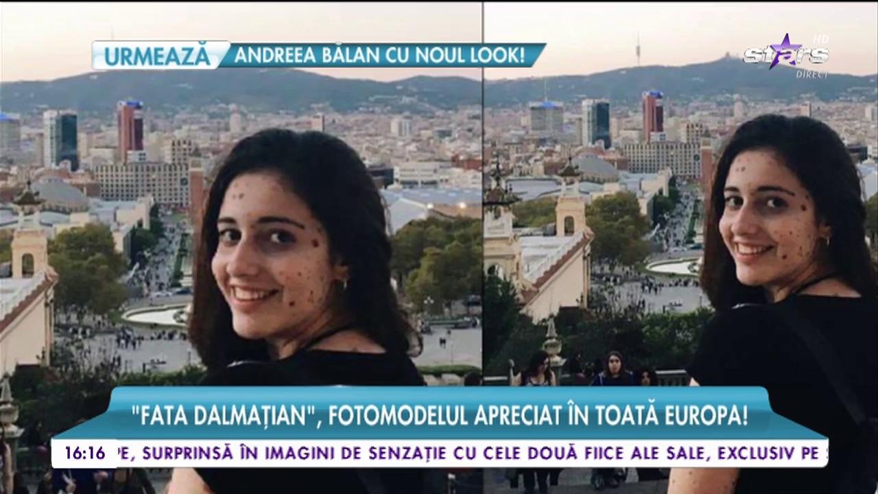 "Fata dalmaţian", fotomodelul apreciat &icirc;n toată Europa! T&acirc;năra s-a născut cu nu mai puţin de 500 de semne pe corp!