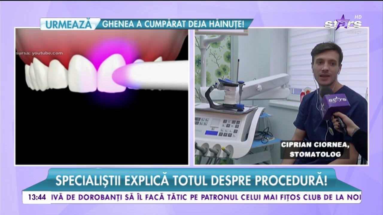 Faţetele pentru dinţi, pericole şi beneficii! Specialiştii explică totul despre procedură!