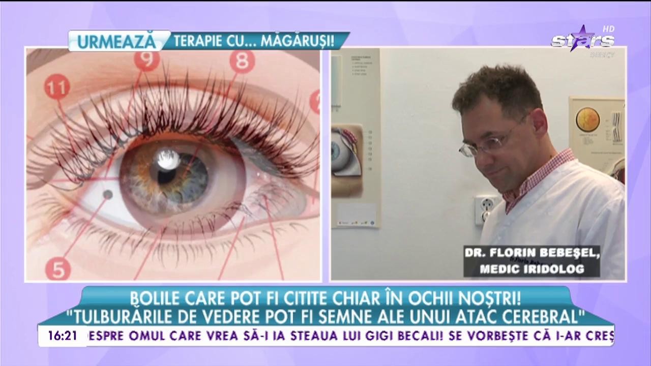 Bolile de pot fi citite chiar &icirc;n ochii noştri! Cum afli că trebuie să mergi la doctor doar privind &icirc;n oglindă!