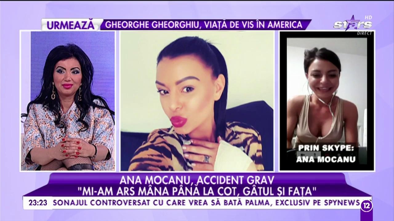 Primele declaraţii ale Anei Maria Mocanu, după ce s-a ars cu ULEI pe m&acirc;nă, g&acirc;t şi faţă: "E carne vie, nu pot să mă spăl singură sau să mă &icirc;mbrac"