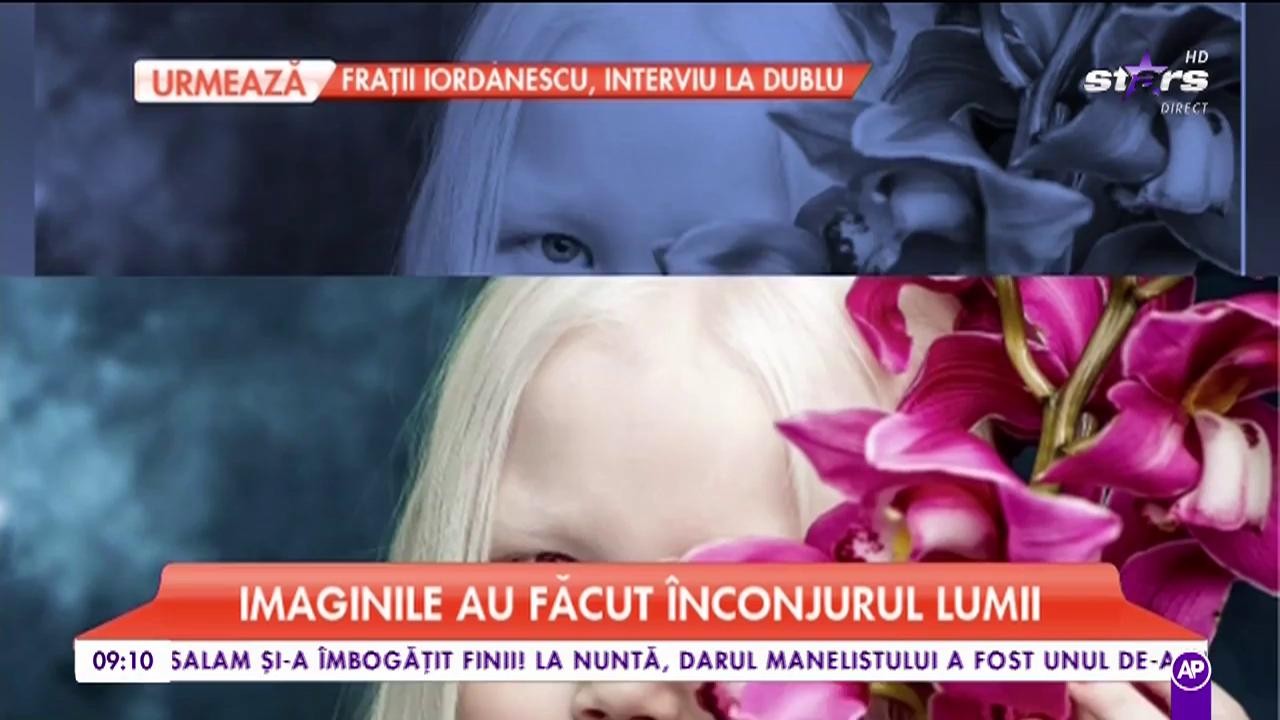 Nariyana, o fetiță de opt ani, suferă de albinism. Boala a transformat-o &icirc;ntr-una dintre cele mai dorite fotomodele