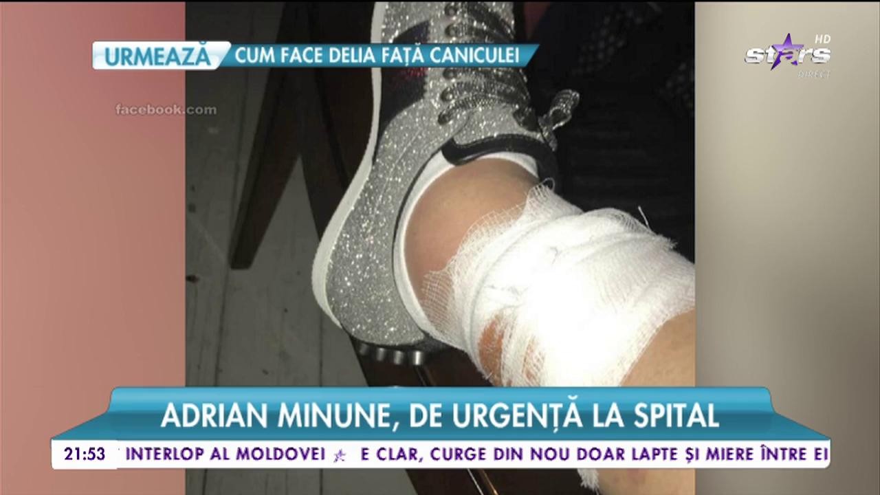 Adi Minune, de urgență la spital! Artistul are o rană gravă la picior