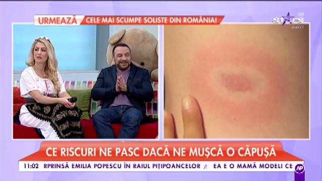 Cum ne tratăm după ce suntem mușcați de căpușe