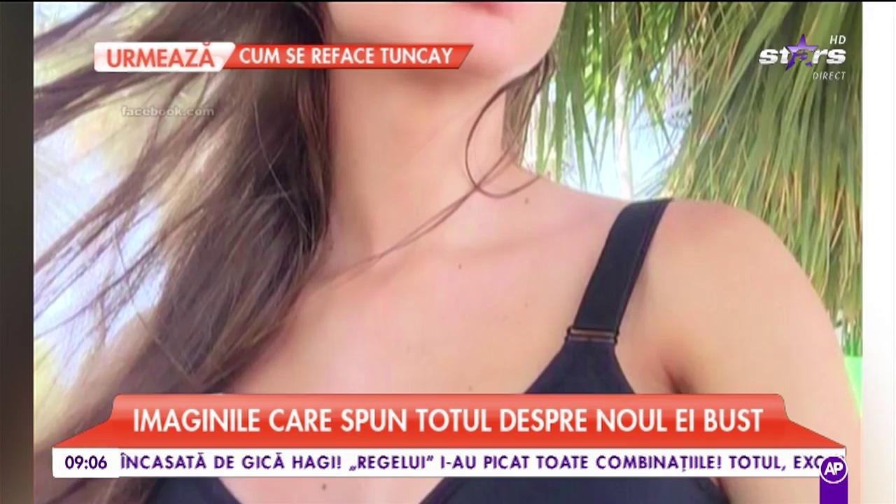 Otilia Bilionera, imaginile care spun tot despre noul ei bust