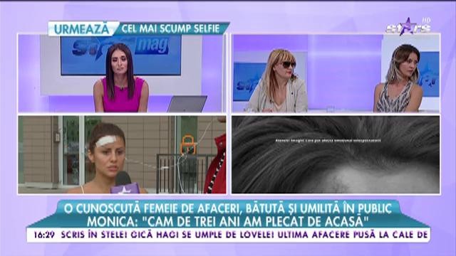 O cunoscută femeie de afaceri &icirc;şi acuză iubitul că a bătut-o!