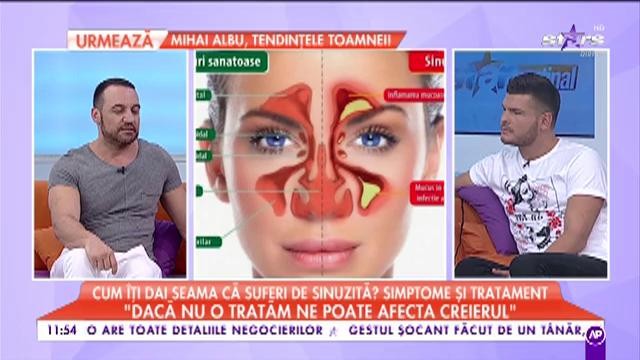 Cum &icirc;ți dai seama că suferi de sinuzită