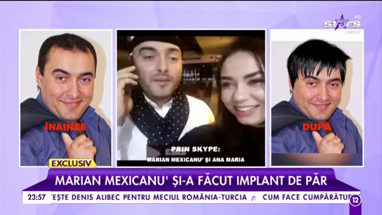 Marian Mexicanu, primele imagini după operație. Vedeta va obține rezultatul dorit &icirc;n 6 luni