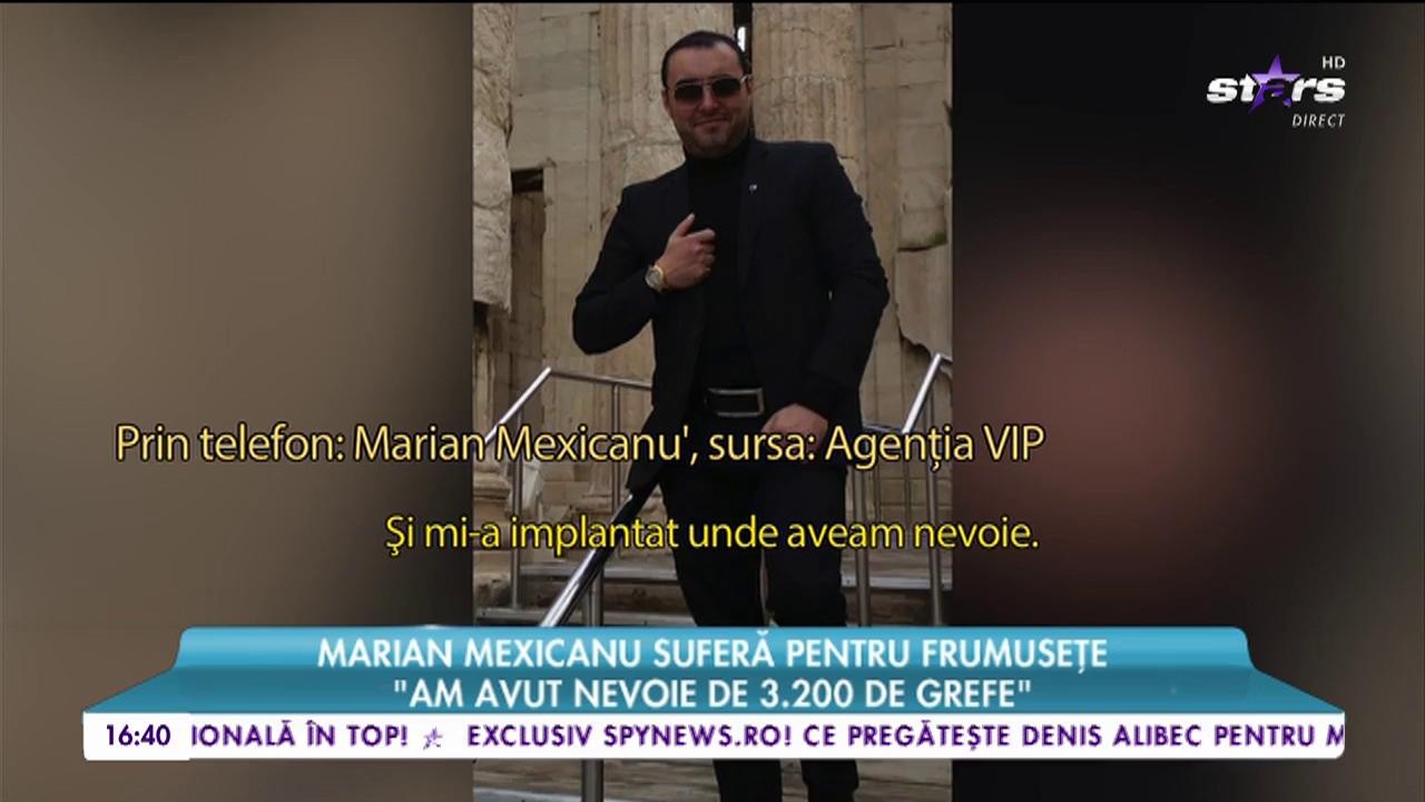 Marian Mexicanu sufera pentru frumusete: &rdquo;Mi-am implantat păr unde trebuia&rdquo;