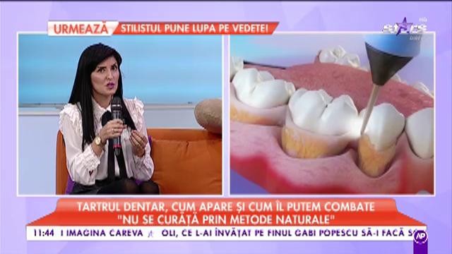 Știai că tartrul dentar trebuie &icirc;ndepărtat periodic?