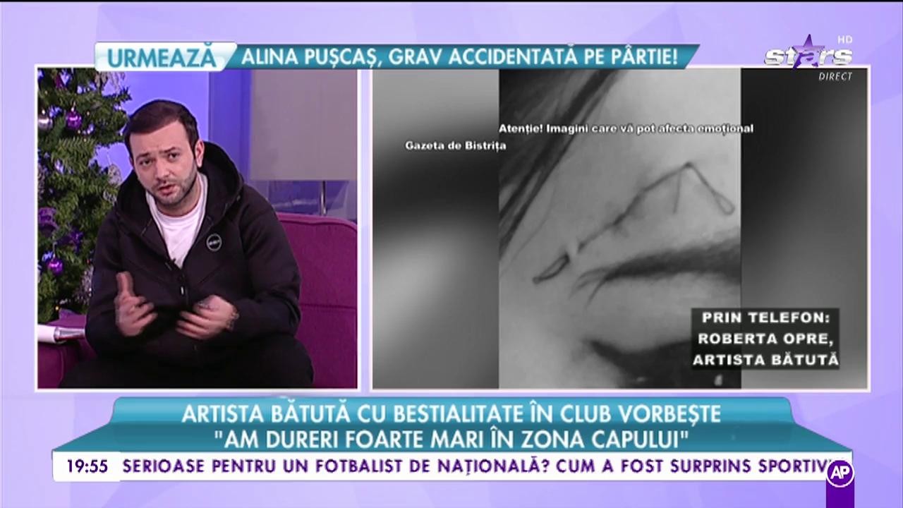 Artista bătută cu bestialitate &icirc;n club vorbește: &rdquo;Și soțul meu are sechele
