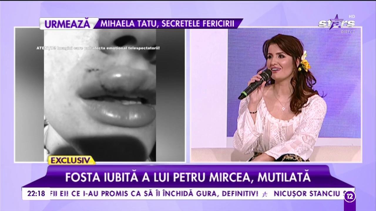 Geanina Manea, fosta iubită a lui Petru Mircea, mutilată de muşcătura unui c&acirc;ine!