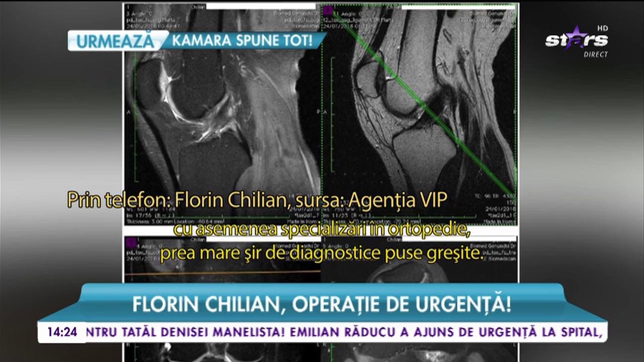 Florin Chilian, operație de urgență! &bdquo;Este un șir de &icirc;nt&acirc;mplări pline de amărăciune&rdquo;