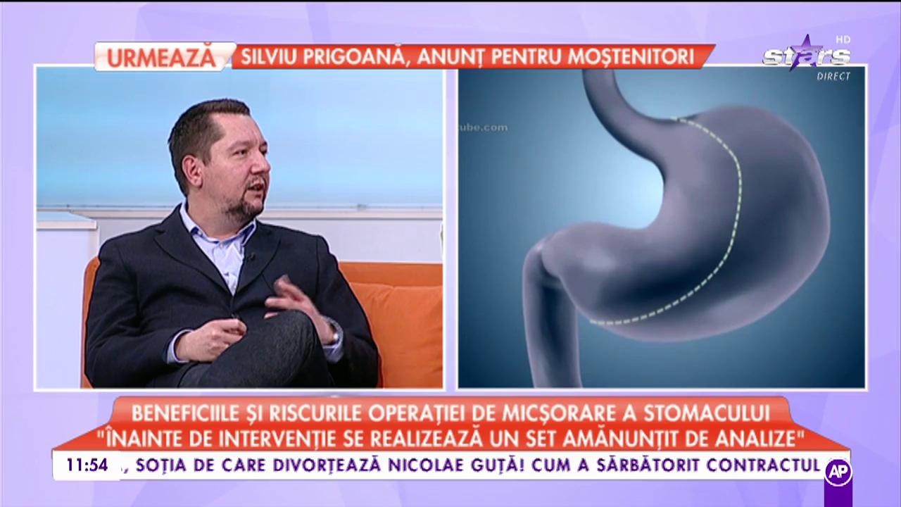 Beneficiile și riscurile operației de micșorare a stomacului: ”Se taie două treimi din stomac”