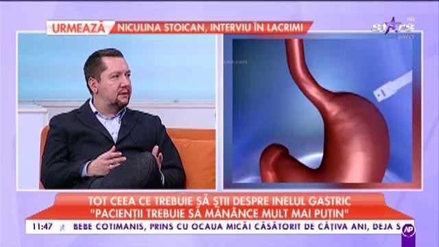 Tot ce trebuie să știi despre balonul și inelul gastric. Beneficiile și riscurile intervenției