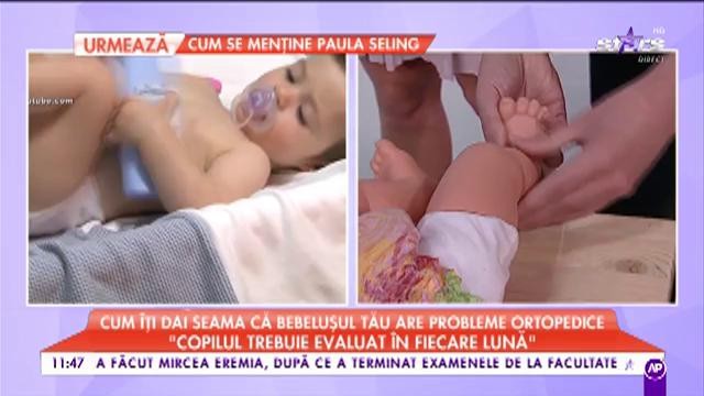 Știai că și bebelușii pot avea probleme ortopedice? „Copilul trebuie evaluat în fiecare lună”