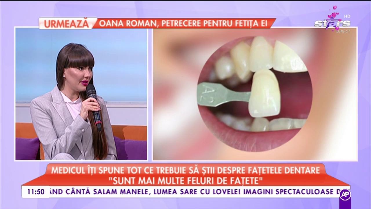 Tot ce trebuie să știi despre fațetele dentare. Medicul spune tot ce trebuie să știi despre procedură