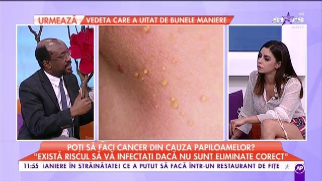 Te confrunți și tu cu papiloamele? ”Pot să ajungă până la 5 centimetri”