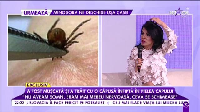 Clipe de groază pentru soacra lui Pitbull! A fost mușcată și a trăit cu o căpușă &icirc;nfiptă &icirc;n pielea capului