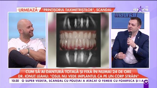 Cum să ai dantură totală și fixă în numai 24 de ore